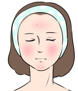 炎症